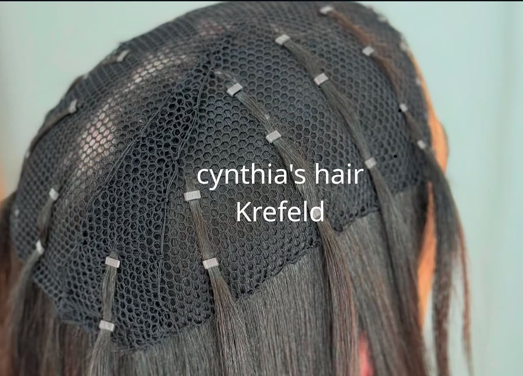 mesh integration u.a. bei alopecia